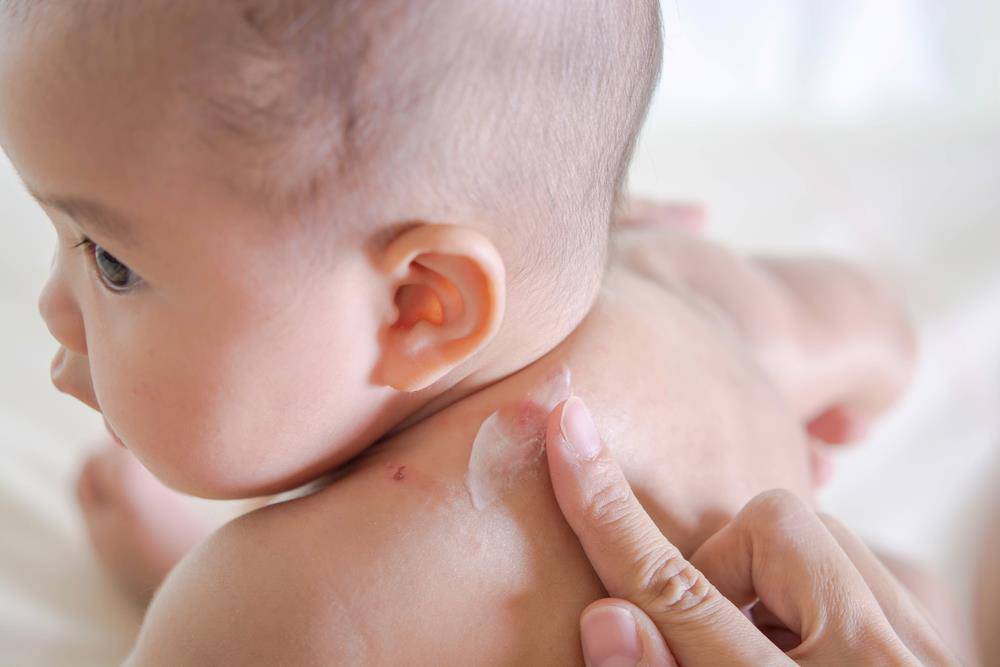 Trẻ sơ sinh cũng cần được chăm sóc và dưỡng ẩm để bé có được làn da mịn màng